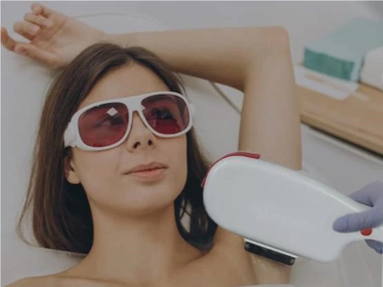IPL and Diode Laser Hair Removal Technology, Which is the Best