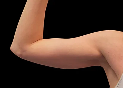 Can It Be Easier to Have Shaped Muscles?