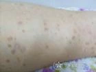 Kusursuz bir cilde sahip olmak için ihtiyacınız olan şey budur
