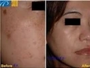 Kusursuz bir cilde sahip olmak için ihtiyacınız olan şey budur