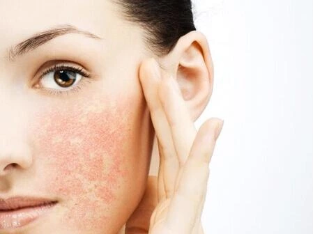 What Are the Best Practices for Repairing Sensitive Skin?