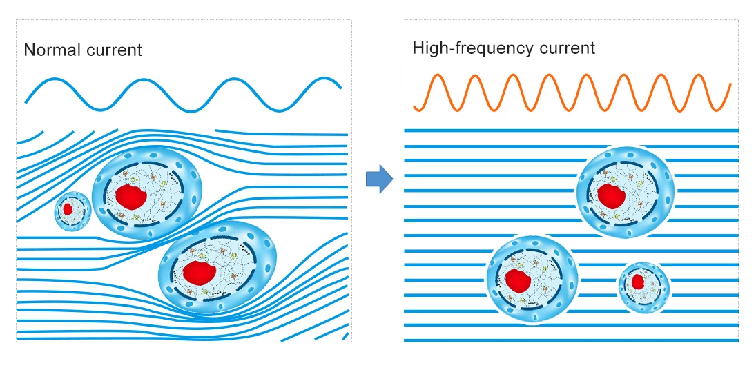 How Does RF Therapy Contribute to Optimal Body Health?