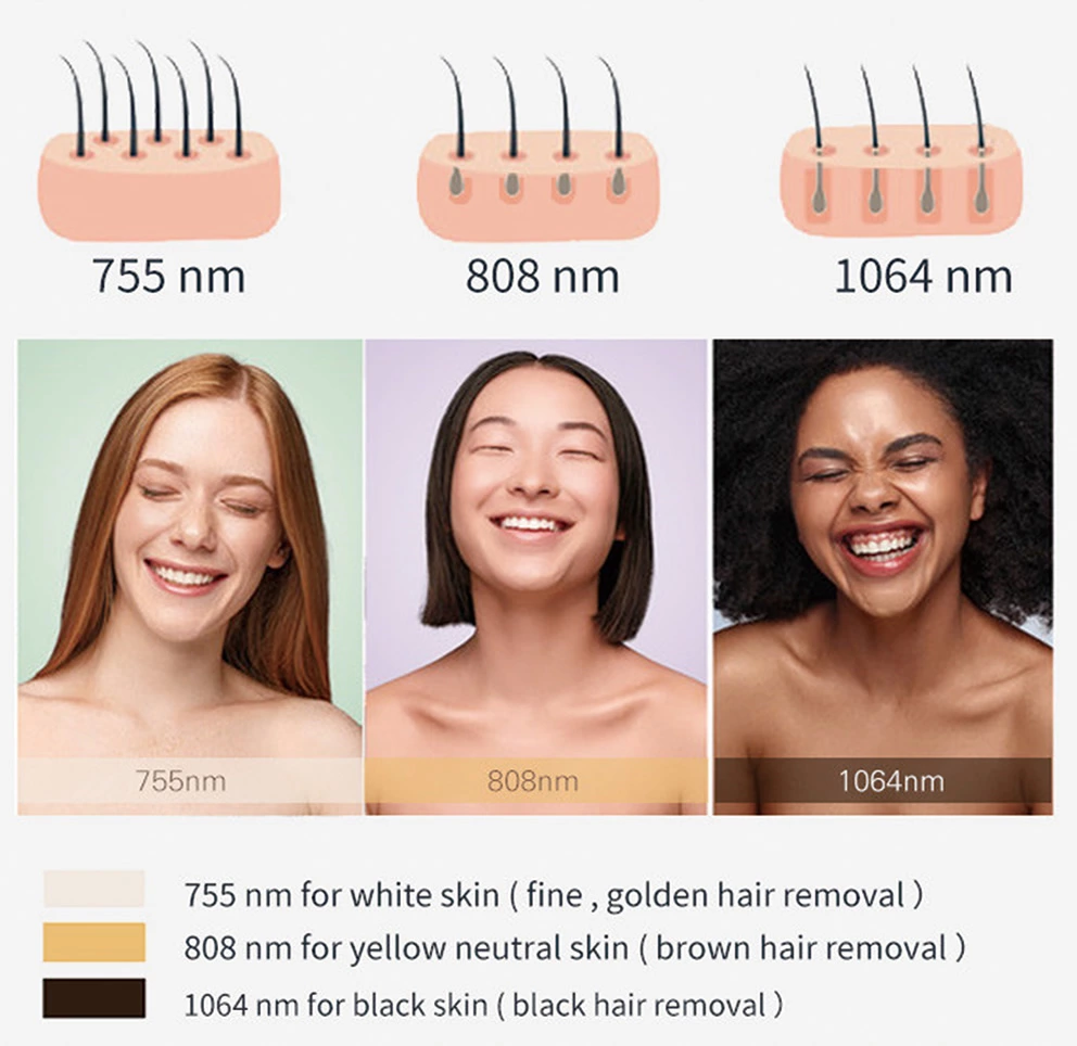 Diode Laser Hair Removal Machine