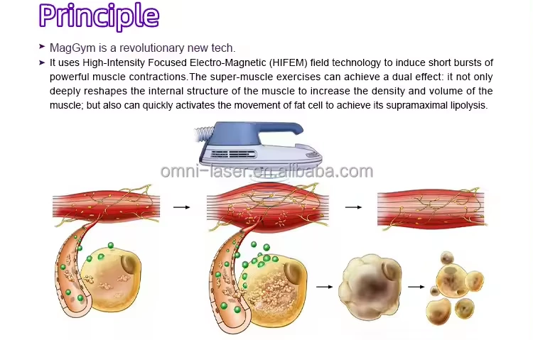 Can EMT Be the Key to Effective Muscle Sculpting and Shaping?