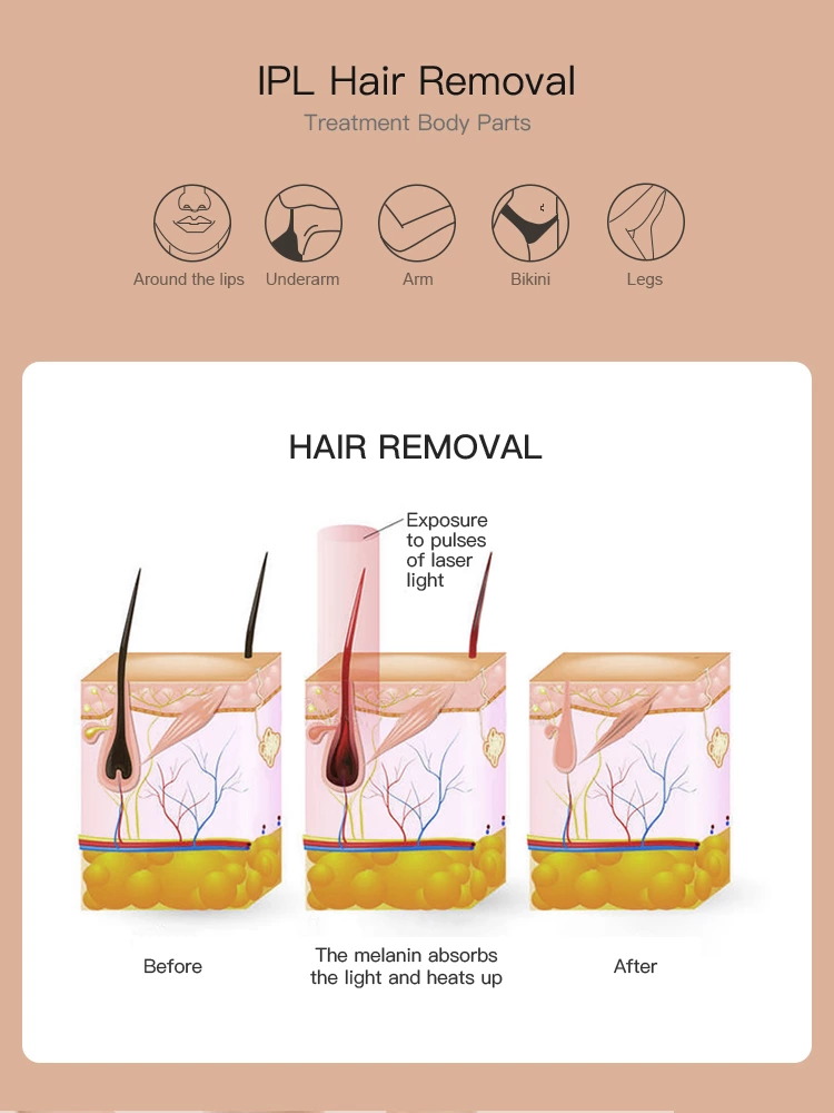 Who can bring a brand new Comfortable and effective hair removal Experience ?