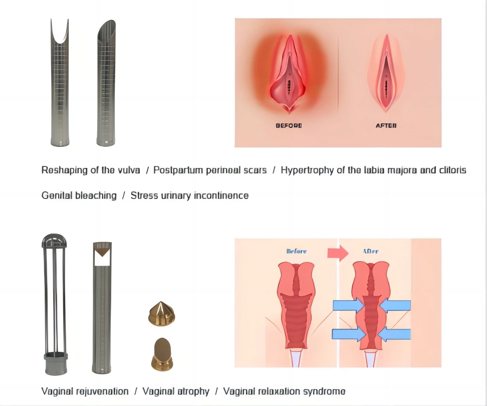 Can CO2 Lasers Be Used in Anti-Aging Treatments？