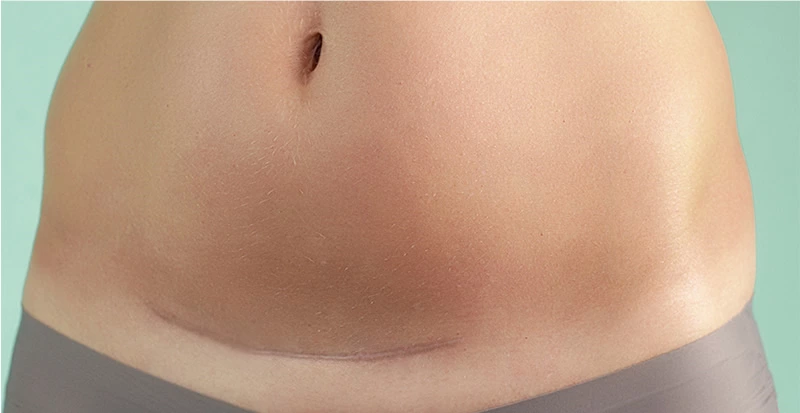 Body Healthy and Skin Tightening Machine