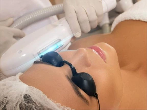 How Does IPL Treatment Work for Acne Scars and Skin Rejuvenation?