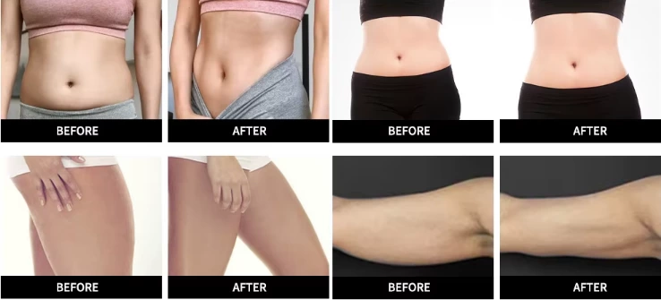 Body Roller Contouring Machine