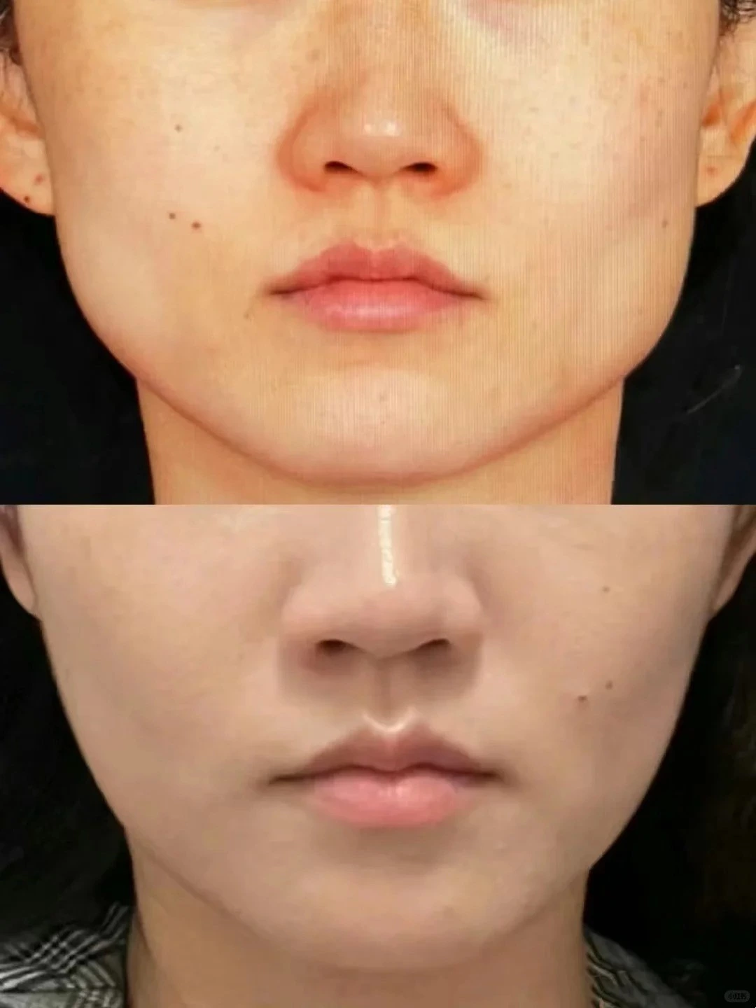 Anti-Aging Magnetic Face Lift Machine