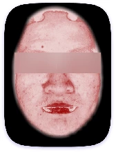 Facial Skin Analyzer Machine