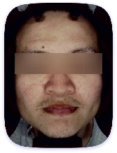 Facial Skin Analyzer Machine
