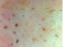 Facial Skin Analyzer Machine