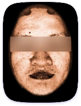 Facial Skin Analyzer Machine