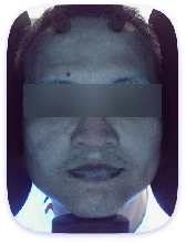 Facial Skin Analyzer Machine