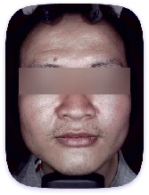 Facial Skin Analyzer Machine