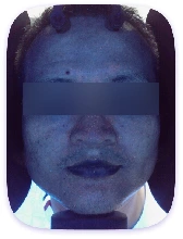 Facial Skin Analyzer Machine