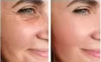 RD-MC100 Multi functional Fascia Roller Beauty Machine – The Future of Non-Invasive Skin & Muscle Rejuvenation