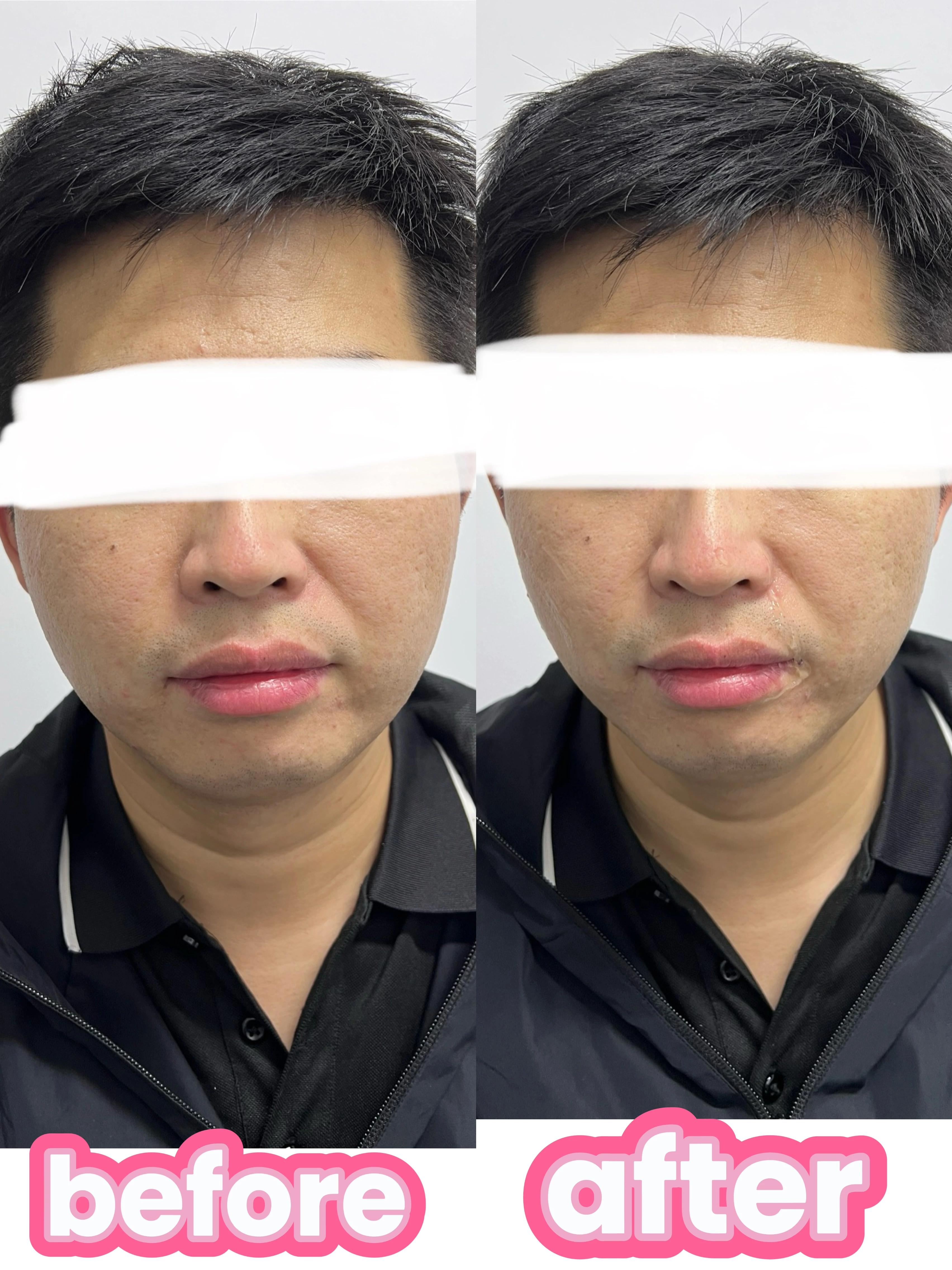 RD-MC100 Muscle Cyclone Wave Relaxing System: Advanced Triple-Frequency Technology for Deep Skin & Muscle Renewal