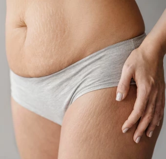 Cold Plasma (Part 1) – The Root Cause of Recurrent Acne and the Revolutionary Bactericidal Solution: How Plasma Targets Bacteria at the Source