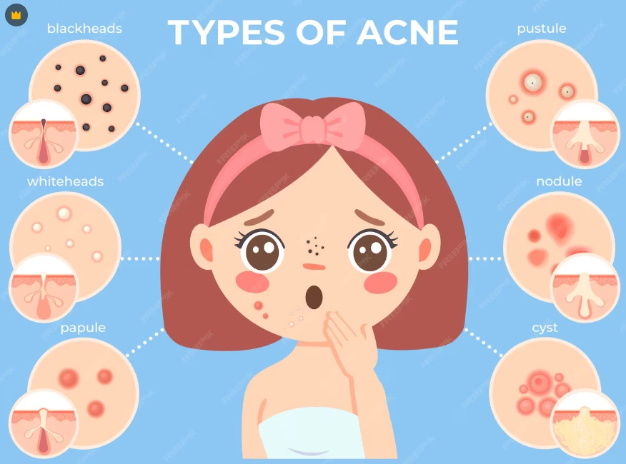 Cold Plasma(Part 3)Breaking Through Traditional Bottlenecks: How Plasma Technology is Reshaping High-Efficiency Skin Management