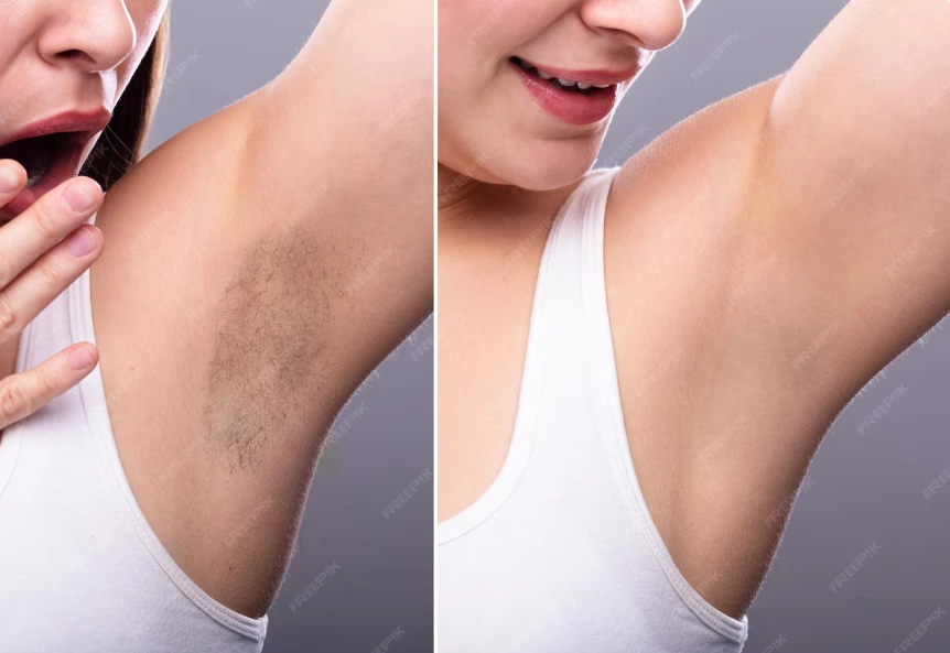 IPL (Part 2) – What Can IPL Really Do, and Why Does It Work?