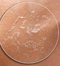 Oxygen Bubble Facial Series (Part 4) | Why is Skin Still Dry After Cleansing?