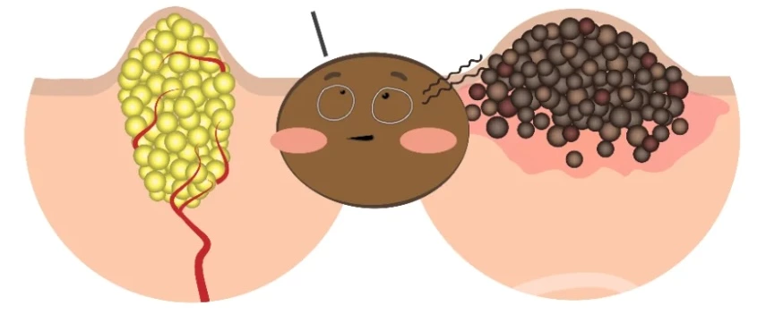 Oxygen Bubble Facial Series (Part 5) | Why Must “Cleansing Care” Also Sterilize? (Core: Ozone / Plasma)