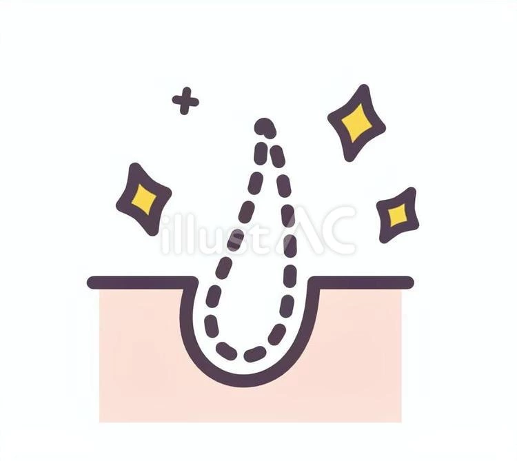 How to Choose an 808 Diode Laser Hair Removal Machine That Delivers Long-Term Profit