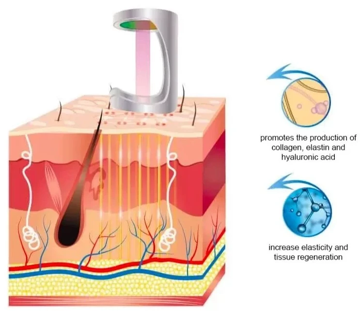 Fractional CO₂ Laser vs Other Skin Resurfacing Treatments: Which Option Is Best?