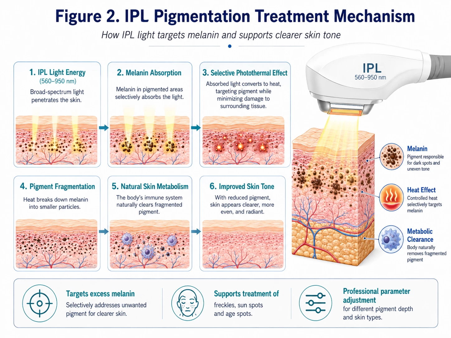 IPL pigmentation treatment mechanism showing melanin absorption and pigment fragmentation
