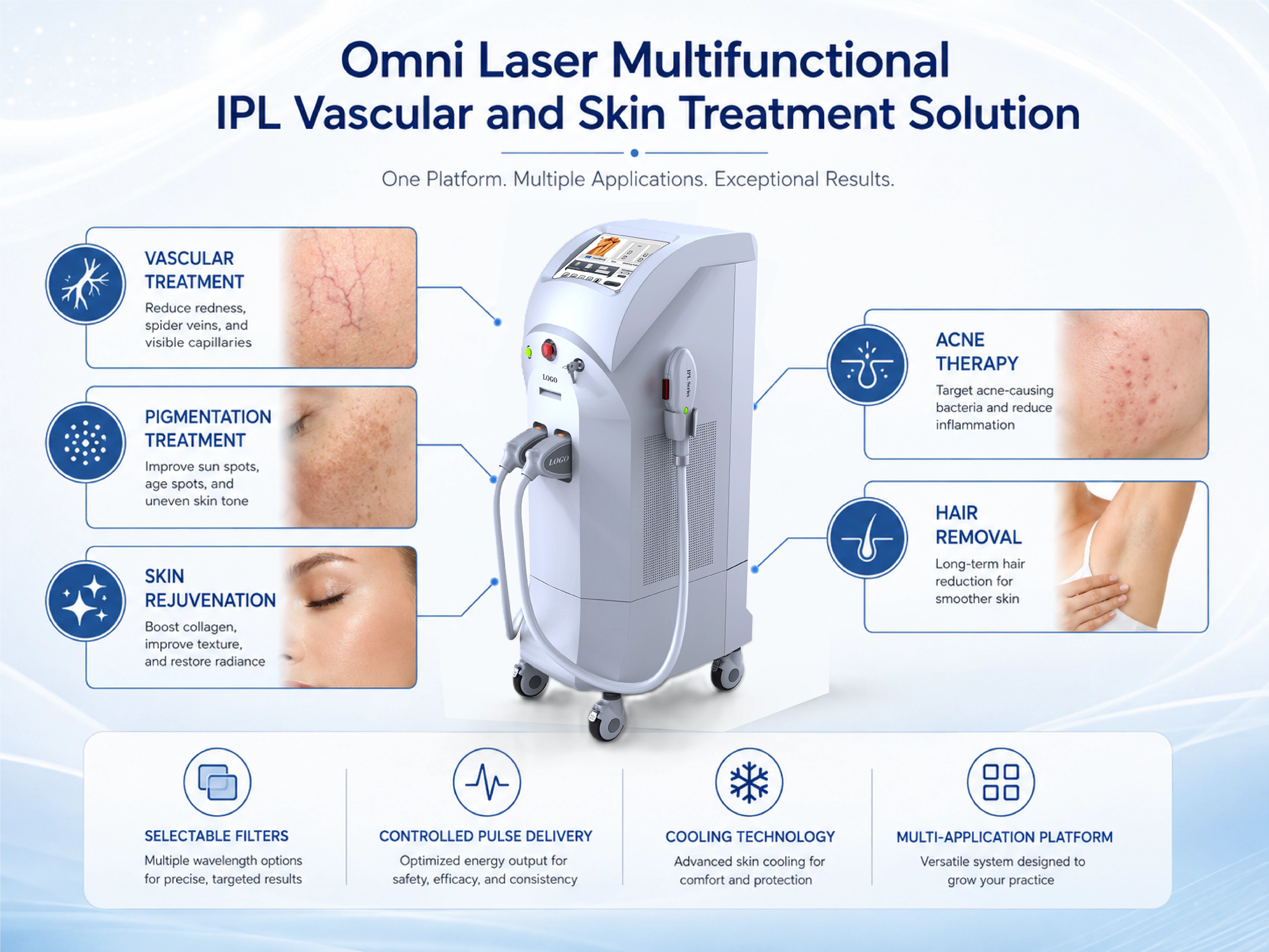 Omni Laser Multifunctional IPL Vascular and Skin Treatment Solution Omni Laser multifunctional IPL system for vascular treatment, pigmentation, skin rejuvenation, acne therapy and hair removal applications