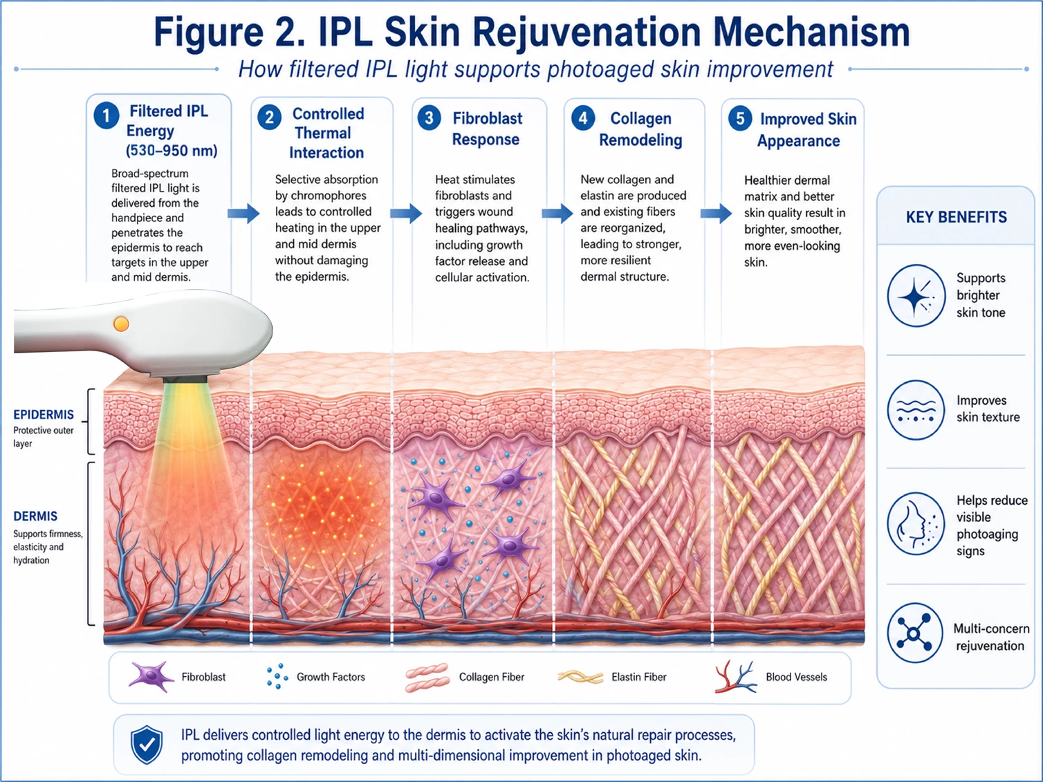 IPL Skin Rejuvenation Mechanism IPL skin rejuvenation mechanism showing filtered light energy, dermal thermal interaction, fibroblast response and collagen remodeling