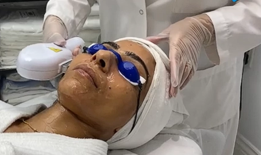 professional-ipl-skin-rejuvenation-treatment-clinic