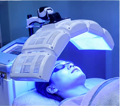 Blue LED Light Therapy for Acne-Prone and Oily Skin Professional blue LED light therapy for acne-prone and oily skin in an aesthetic clinic